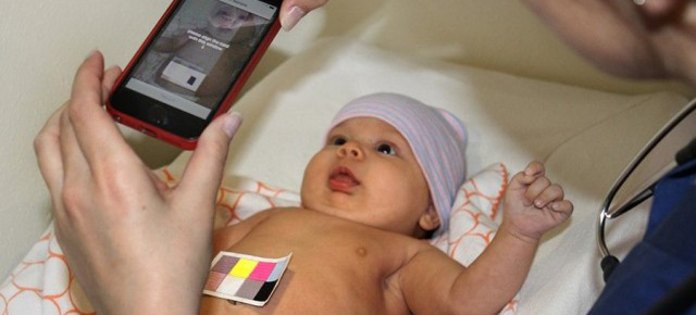 App Turns Your Phone’s Camera Into A Jaundice-Detecting Paediatrician