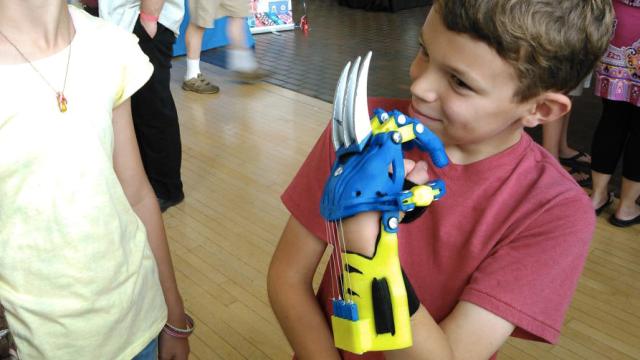 3D-Printed Wolverine Claws Turn Kids With Prosthetics Into Superheroes