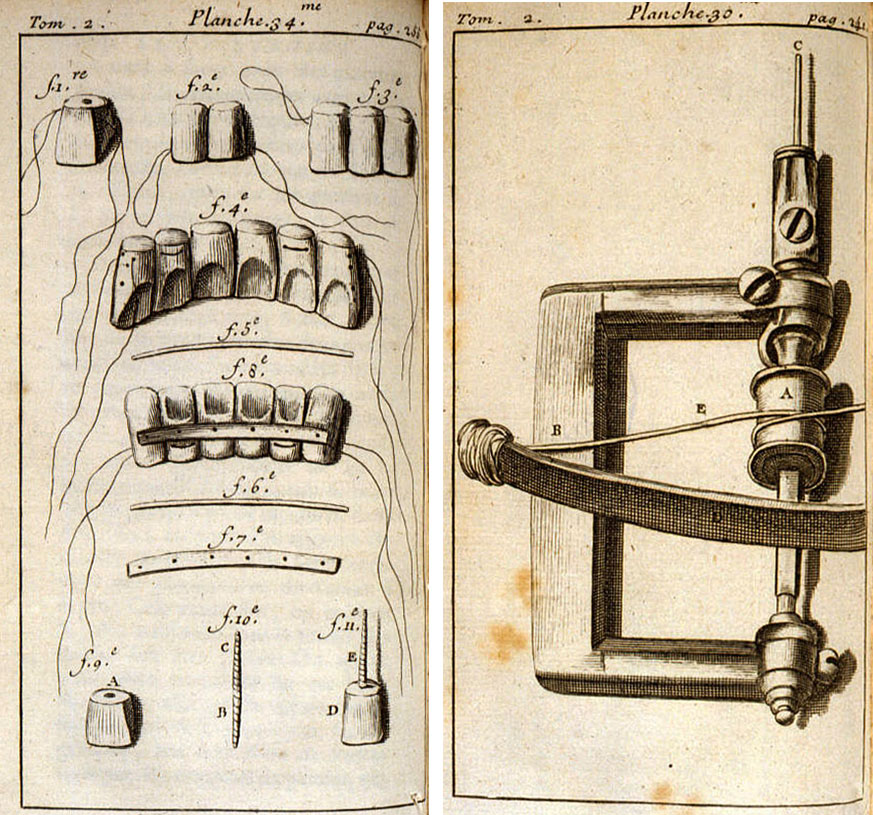 Bloodletting And Bone Brushes: The White-Knuckle Days Of Early Dentistry