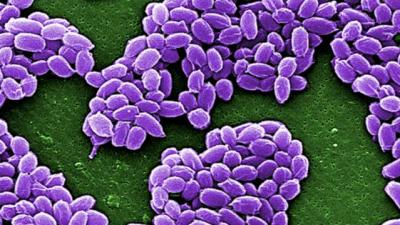 Scientists Are Using Anthrax To Cure Cancer