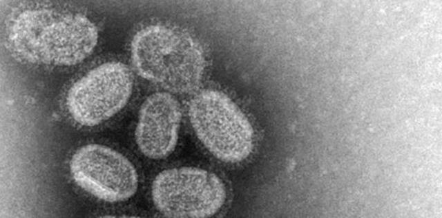 The US Will Stop Funding Research Into Making Mutant Super Viruses