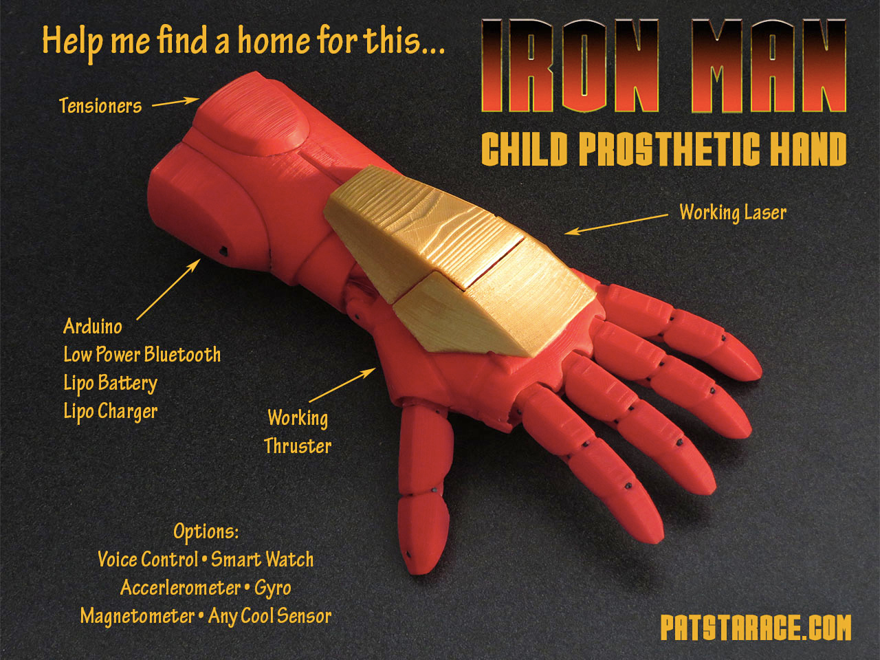 Iron Man Prosthetic Hand Will Make Kids Feel Like Superheroes
