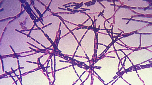 UK Government Lab Accidentally Mailed Out Live Anthrax 