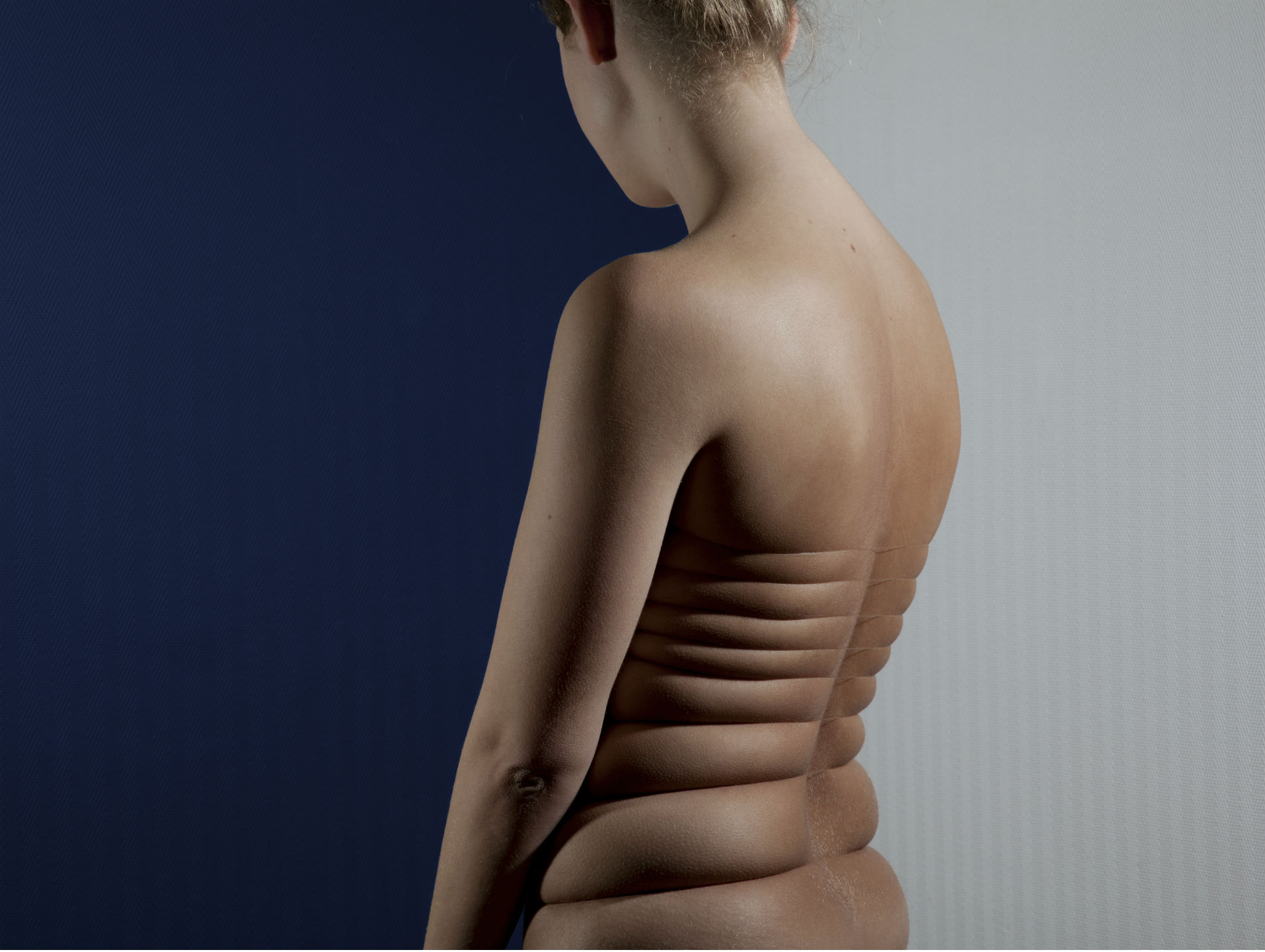 Photographer Stretches Skin To Freaky Limits Without Photoshop