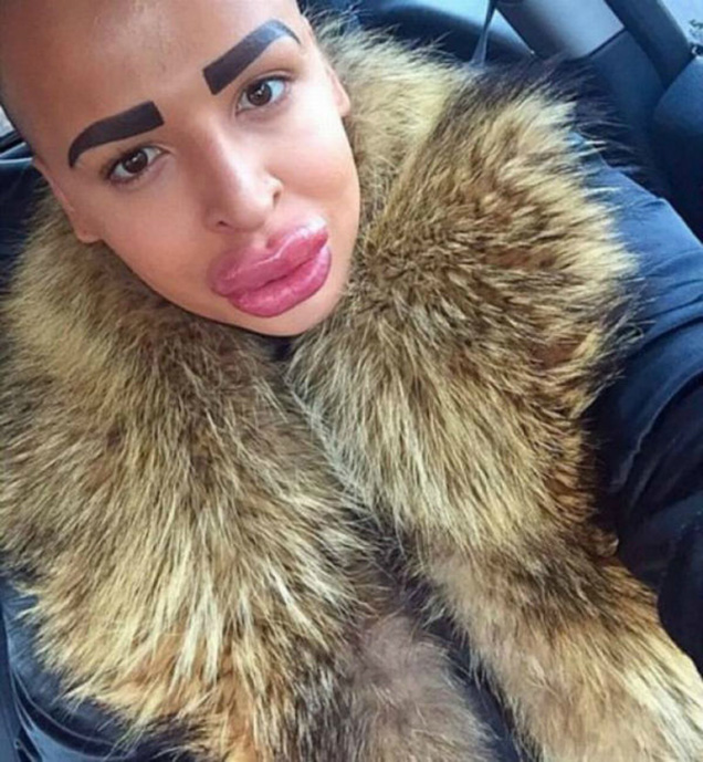 Guy Spends $150,000 In Plastic Surgery To Look Like Kim Kardashian