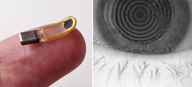 An Eyeball Implant That Makes You Cry
