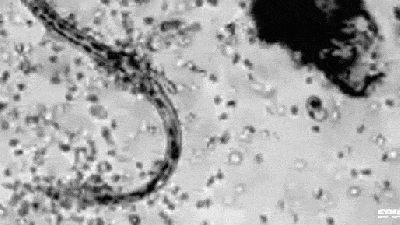 Watch White Blood Cells Swarm And Attack A Parasite
