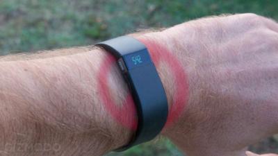Are We Doomed To Get Rashes From Our Fitness Trackers?