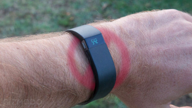 Are We Doomed To Get Rashes From Our Fitness Trackers?