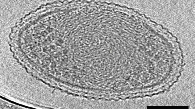 The First Detailed Image Of The World’s Smallest Known Life Form