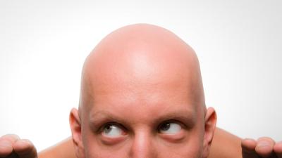 The Best Cure For Balding May Be To Pluck What’s Left
