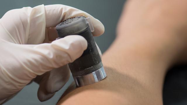 Engineers Made A Simple Device To Numb Skin So Injections Hurt Less