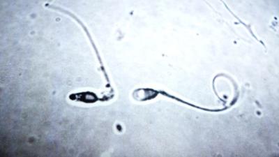How Do Testicles Know When To Stop Making More Sperm?
