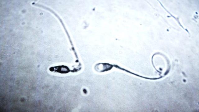 How Do Testicles Know When To Stop Making More Sperm?