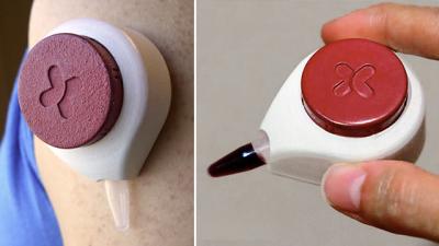This Vampire-Like Suction Device Lets Patients Draw Blood At Home