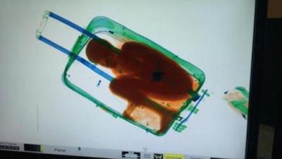 X-Ray Photos Reveal Child Being Smuggled Was Hidden Inside A Suitcase 
