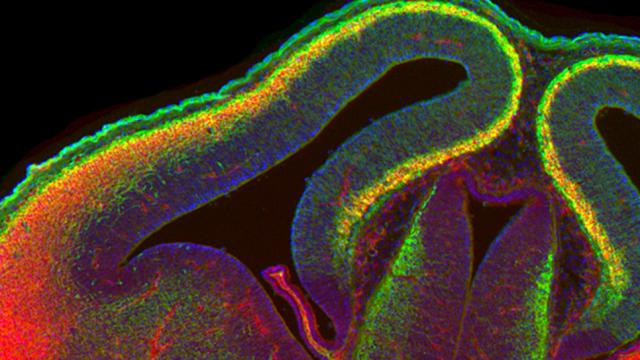 This Is What A Mouse Brain Looks Like When It Rewires Itself
