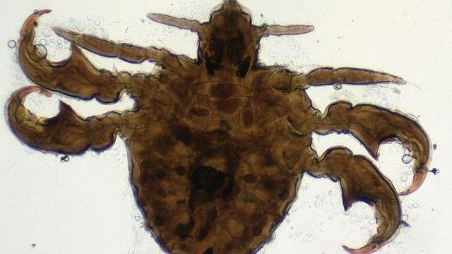 Three Things You Probably Didn’t Know About Crab Lice