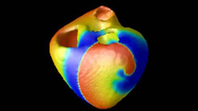 In The Future, A Virtual Heart May Test Your Medical Device For You