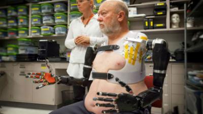 This Man Controls His Robotic Arms With His Mind