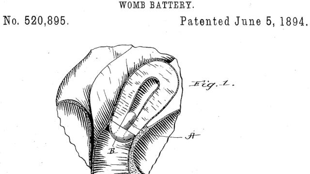 Oh My God, An Electric Dildo From 1894