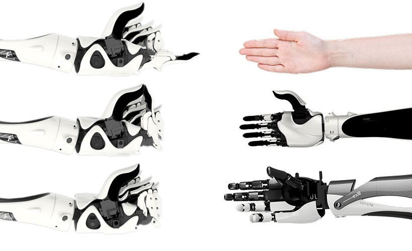 Open-Source Cyborg Hand Is Making Prosthetics More Accessible Than Ever