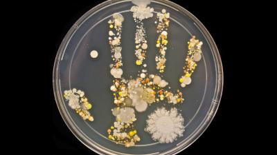 Your Hand Print Is Way More Interesting After A Few Days In A Petri Dish