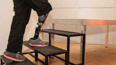 Here’s The First Artificial Leg That Can Feel