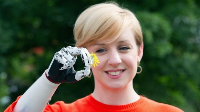 UK Woman Gets “World’s Most Advanced” Bionic Hand Replacement