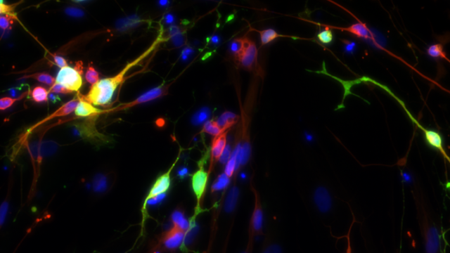Scientists Have Grown Human Serotonin Neurons In The Lab