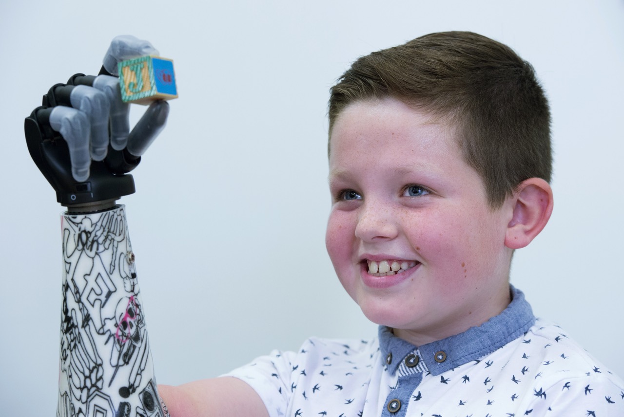 Kid Gets Awesome New Bionic Hand, Reminds Us Not Everything Is Garbage