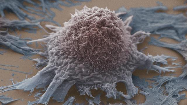 How Starving Cancer Cells Of Sugar Could Be The Best Way To Attack Them