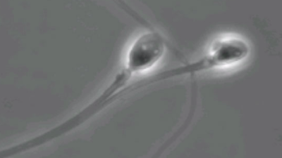 Chemically Freezing Sperm Tails Could Be The Key To A Reversible Male Contraceptive