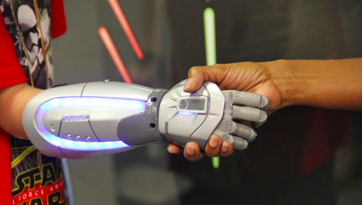 Iron Man, Frozen, And Star Wars Prosthetics Will Boost Kids’ Confidence