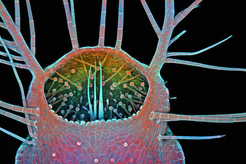 These Are The Best Microscopic Images Of 2015
