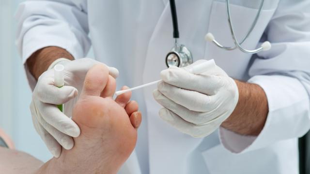 Cold Plasma Could Be Used To Freeze Out Toenail Fungus