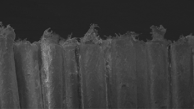 Check Out The Difference Between A New And Used Toothbrush In This Cool Microscopic View