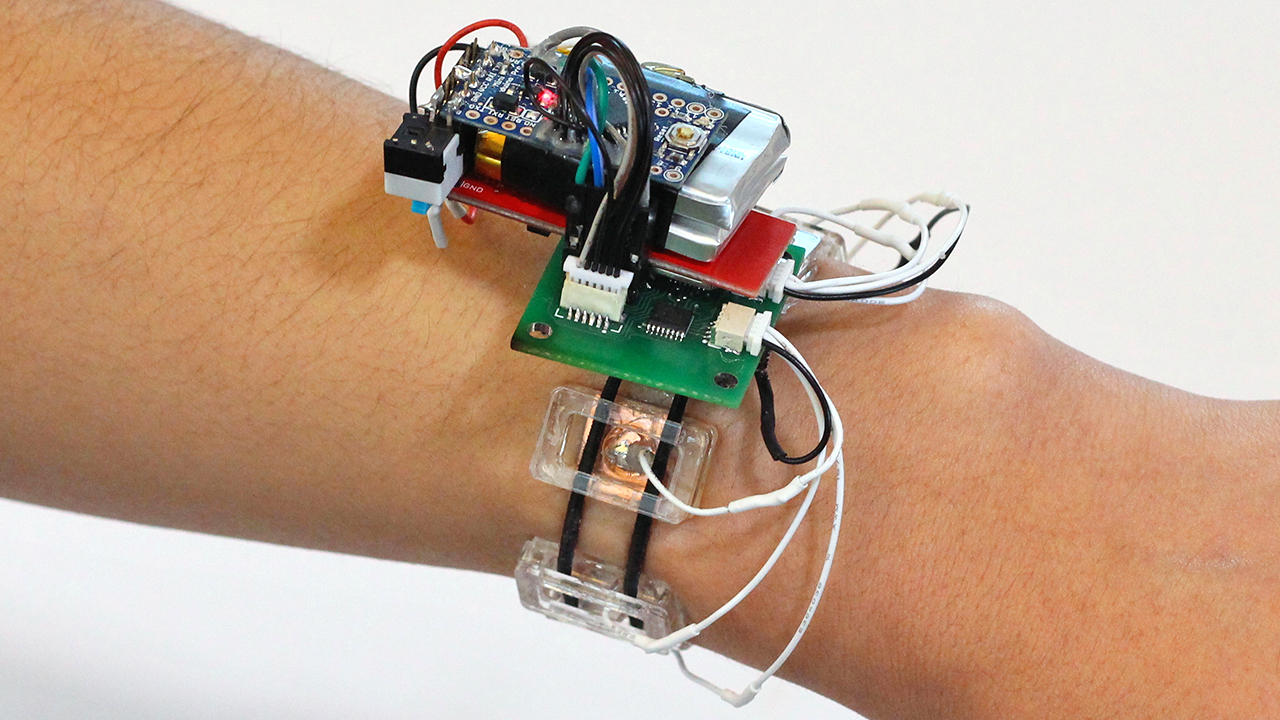 This Smartwatch Detects Gestures By Watching The Muscles Inside Your Arm Move