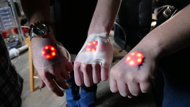 The Latest Trend Among Biohackers Is Implanting LED Lights Beneath Your Skin