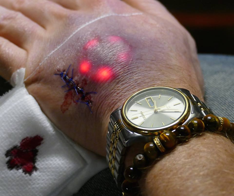 The Latest Trend Among Biohackers Is Implanting LED Lights Beneath Your Skin