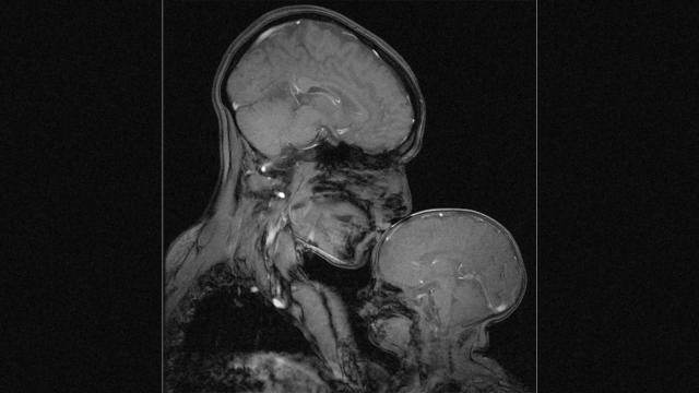 MRI Of Mother And Child Shows Love Through The Eyes Of Science
