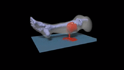Simulation Of A Leg Gushing Blood Is As Gross As You’d Expect