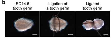 We’re One Step Closer To Being Able To Regrow A Lost Tooth