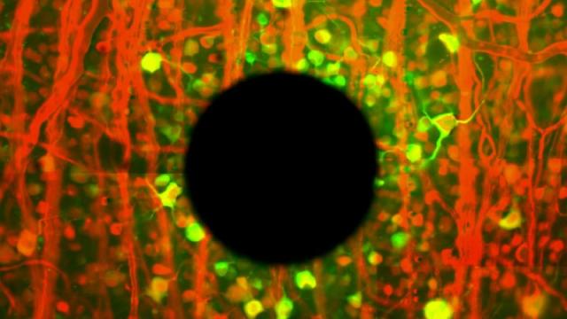 New Research Could Improve Artificial Retinas To Help A Blind Eye See