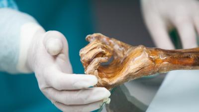 Ötzi The Iceman’s Gut Bacteria Can Help Us Trace Early Human Migration