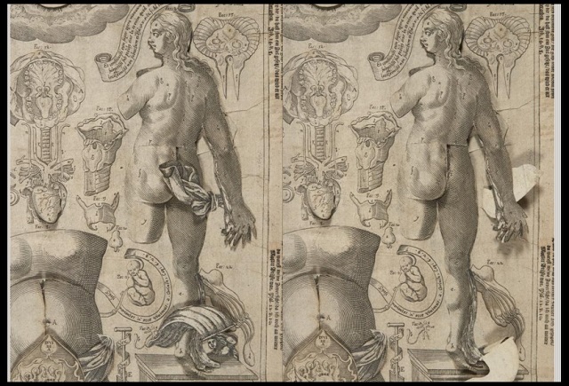Columbia Just Digitised A Bestselling Anatomy Flipbook From The 1600s