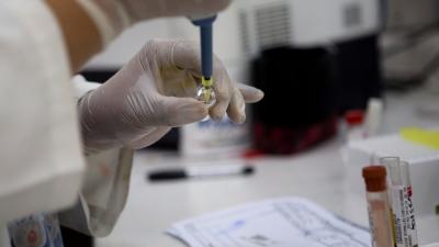 Brazilian Doctors Find Active Zika Virus In Urine And Saliva