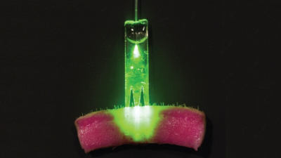 Someday, Suturing A Wound Will Involve Lasers 