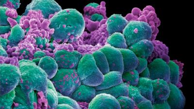 Revolutionary Cancer Therapy Shows Promise In Terminally Ill Patients