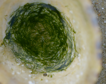 Gaze Into This Vortex Of Worms Trying To Self-Assemble Into A Structure